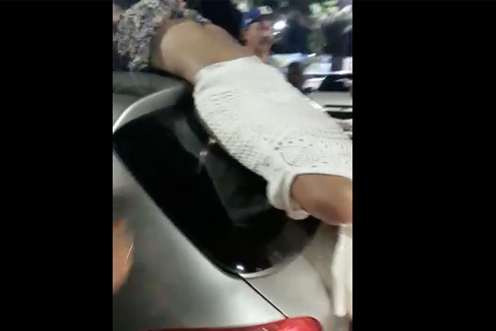 Atropelamento foi atendido pelo Samu Atropelamento ocorreu por volta das 22h